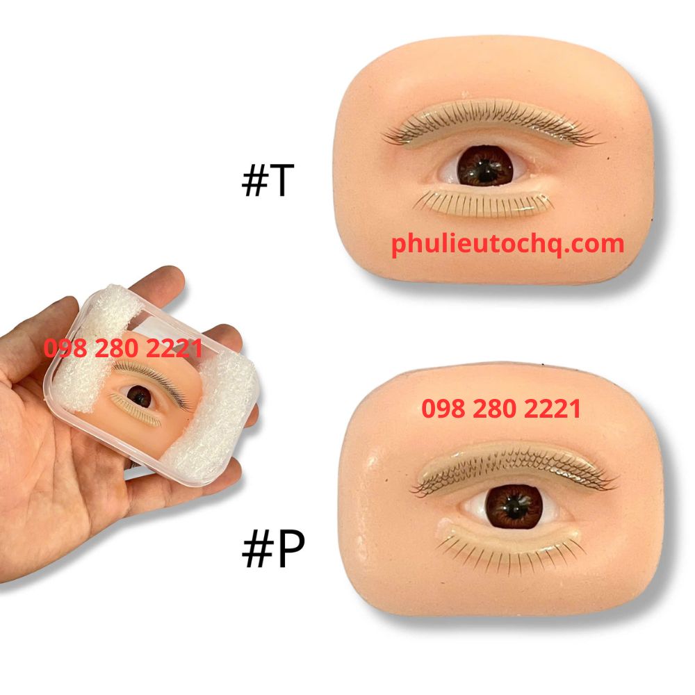 Mắt tập nối mi